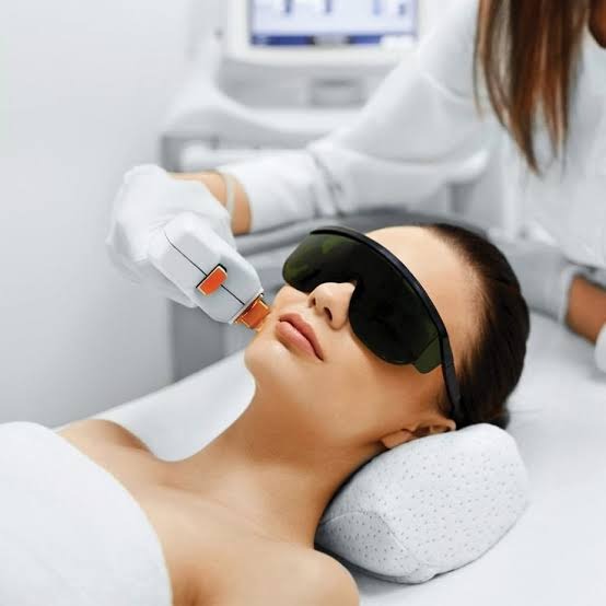 Laser Hair Removal